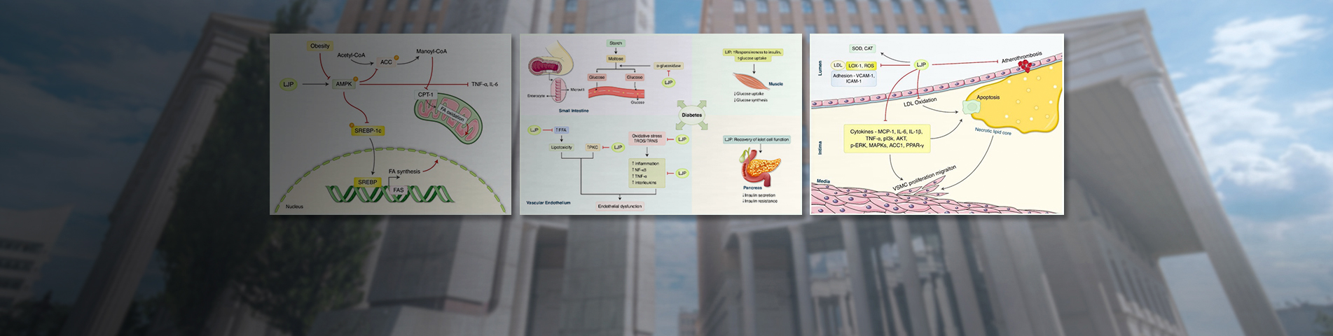 New Treatment Possibility for Metabolic Syndrome